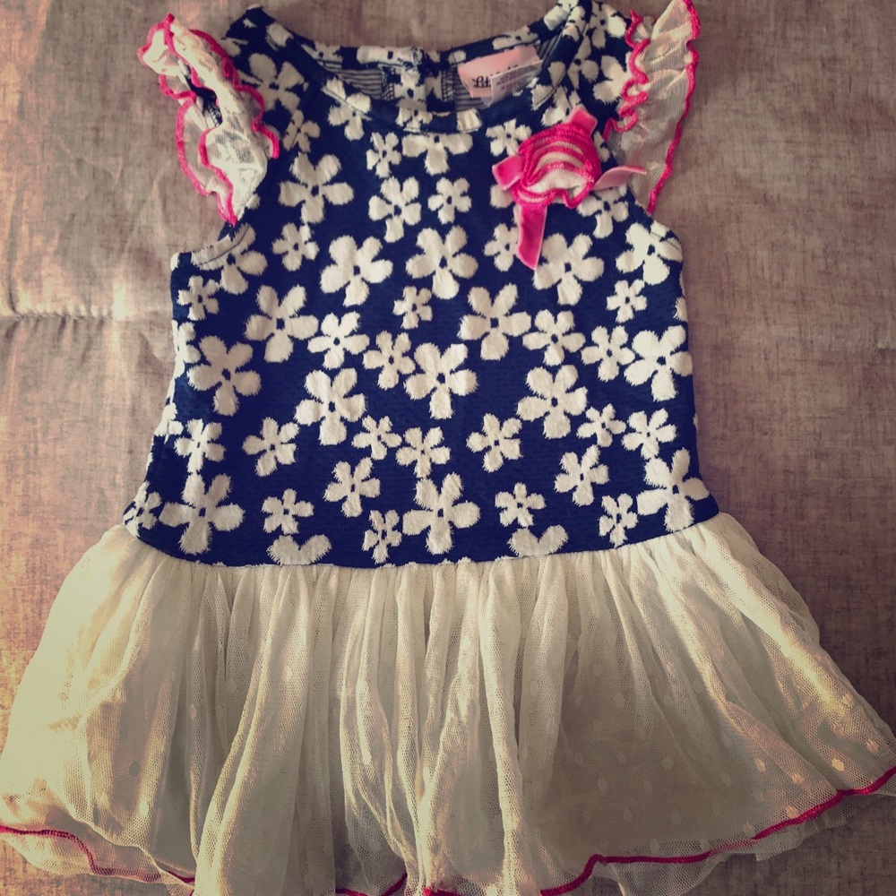 lace dress